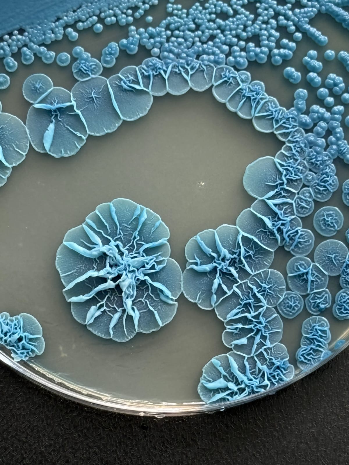 Lodderomyces elongisporus en medio Crhomagar Candida
